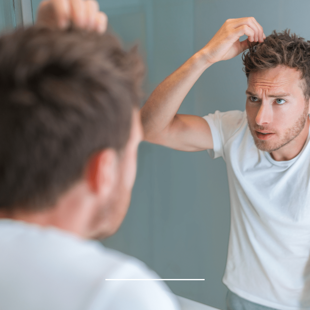 Haaruitval mannen